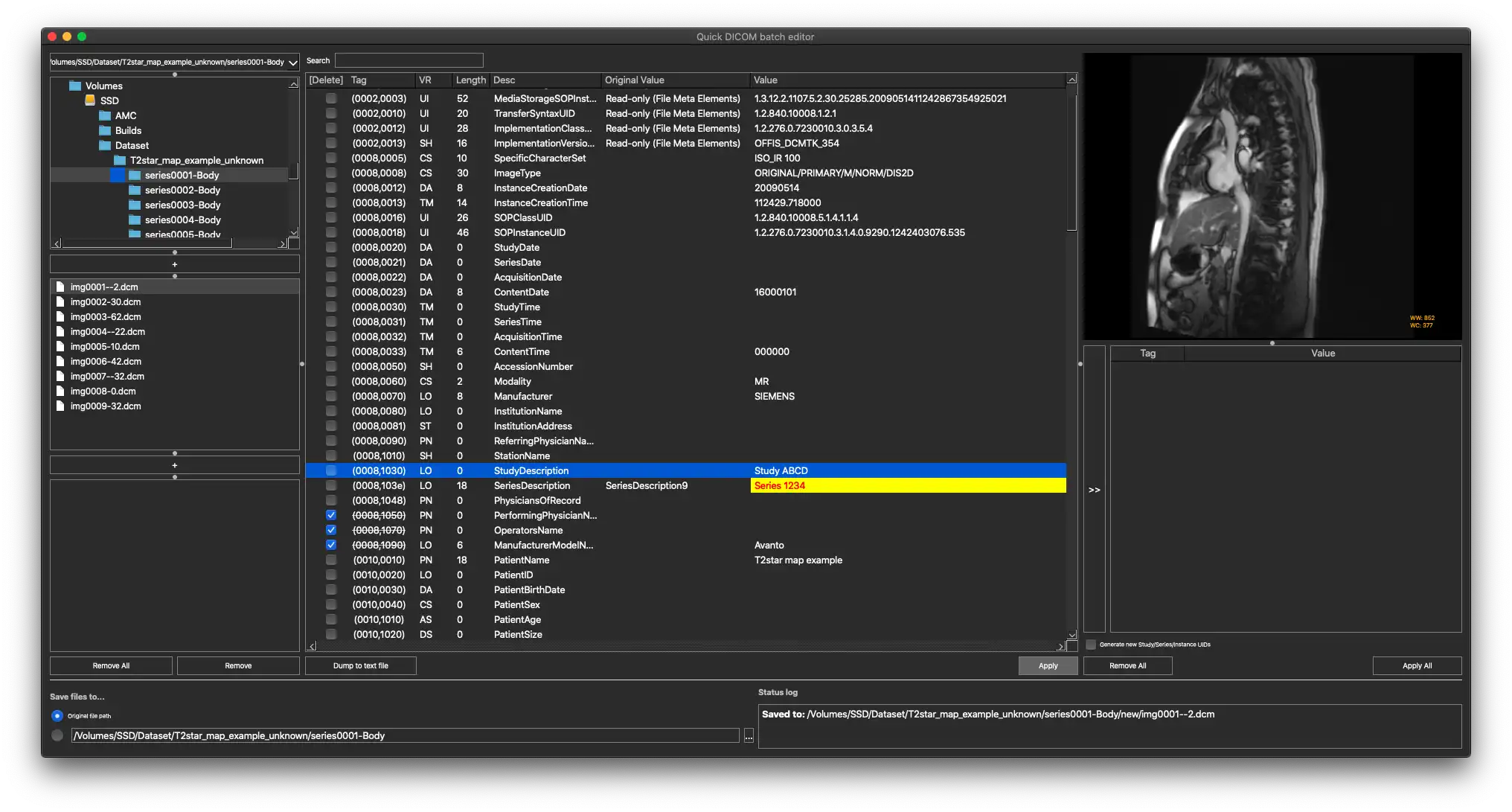 Download web tool or web app Quick DICOM Tag Editor Download web tool or web app Quick DICOM Tag Editor