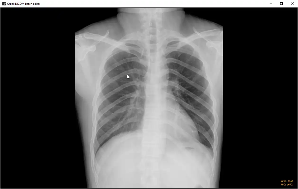 Download web tool or web app Quick DICOM Tag Editor Download web tool or web app Quick DICOM Tag Editor